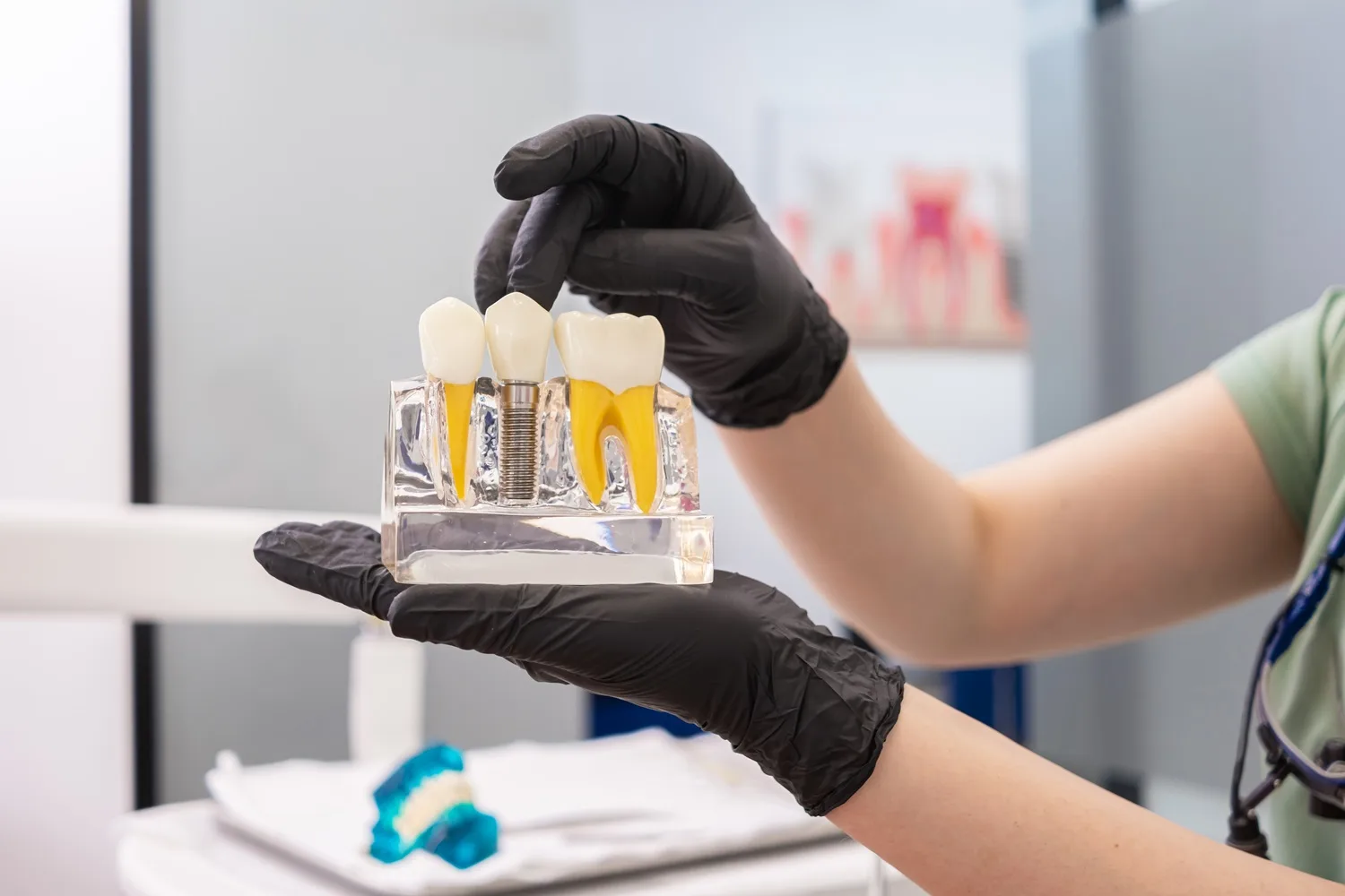 Dental Model Demonstration — Dentist in San Mateo Dentist holding a dental model showing teeth and roots to explain treatment options at a dental clinic in San Mateo