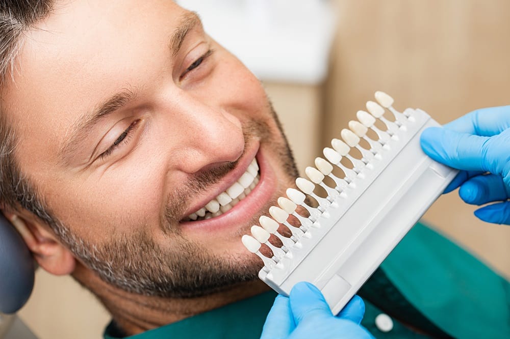 Teeth Shade Matching – Dentist in San Mateo Smiling man at the dentist having his tooth color matched with a shade guide for veneers or whitening — Dentist in San Mateo