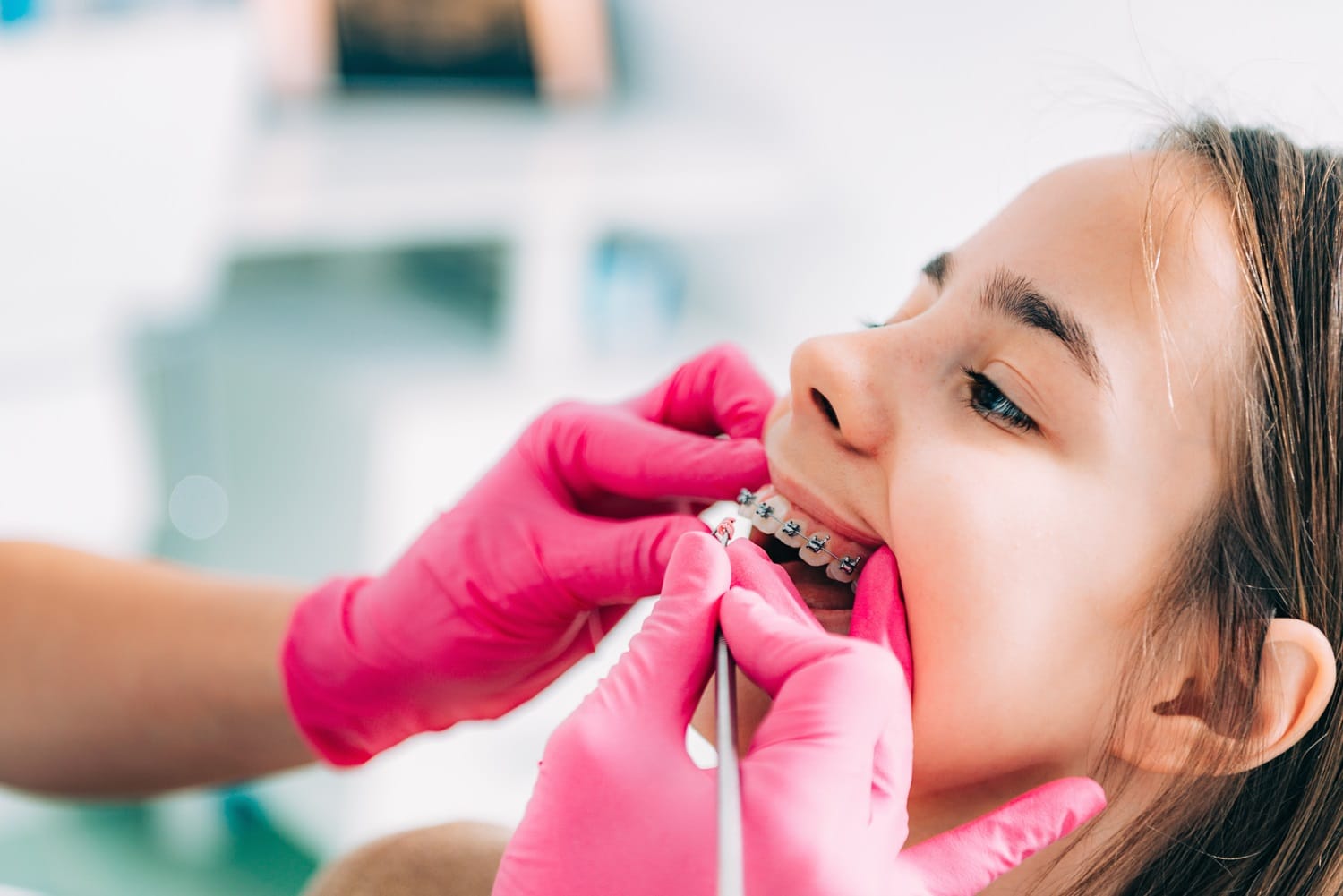 Pediatric dentist adjusting braces for a young patient – Pediatric Dentist San Mateo